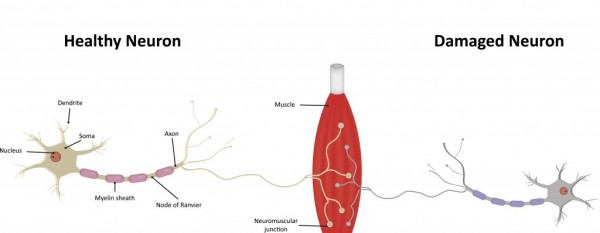 The Beast Healthy Damaged Neuron v2